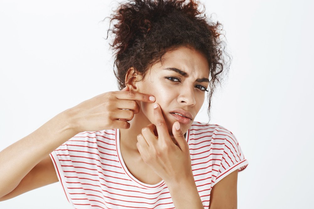 Blackheads removal tips to Avoiding the Common Mistakes